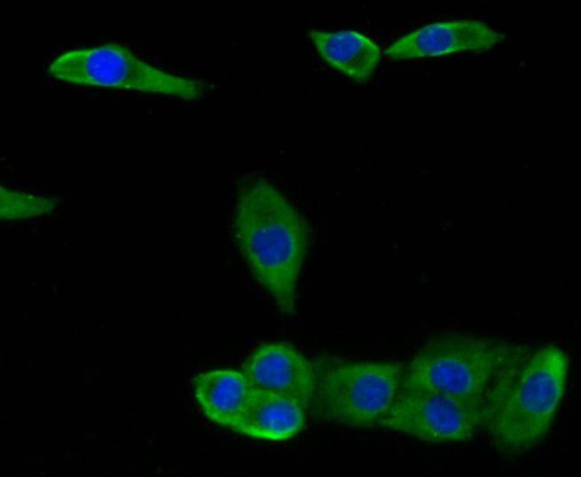 Fig3: Immunocytochemical staining of A549 cells using anti-CCL3 rabbit polyclonal antibody.