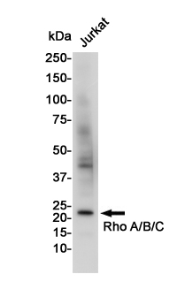 Western blot detection of RhoA/B/C in Jurkat cell lysates using RhoA/B/C Rabbit pAb(1:1000 diluted).Predicted band size:22KDa.Observed band size:22KDa.