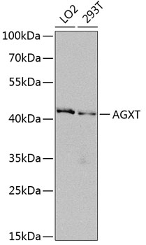 Western blot - AGXT Polyclonal Antibody 