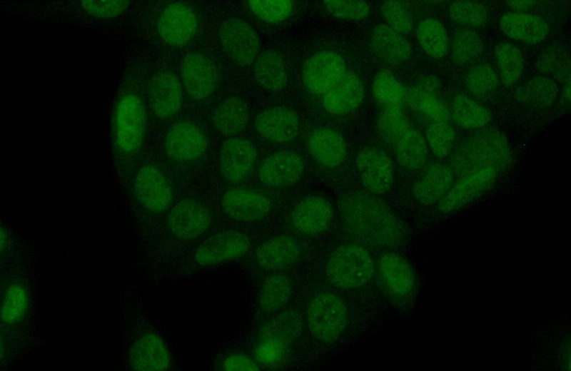 Immunofluorescent analysis of (10% Formaldehyde) fixed HeLa cells using Catalog No:115251(SIX4 Antibody) at dilution of 1:50 and Alexa Fluor 488-congugated AffiniPure Goat Anti-Rabbit IgG(H+L)
