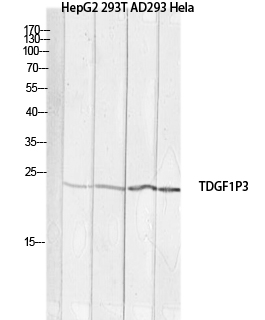 Fig1:; Western blot analysis of HepG2 293T AD293 Hela lysis using TDGF1P3 antibody. Antibody was diluted at 1:1000. Secondary antibody（catalog#：HA1001) was diluted at 1:20000
