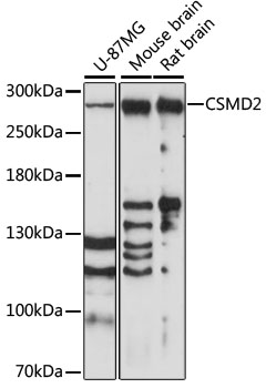 Western blot - CSMD2 Polyclonal Antibody 