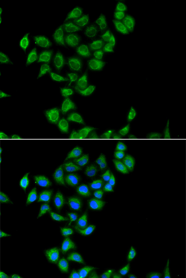Immunofluorescence - COQ3 Polyclonal Antibody 
