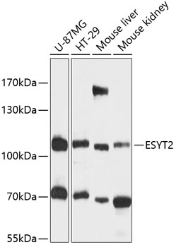 Western blot - FAM62B Polyclonal Antibody 