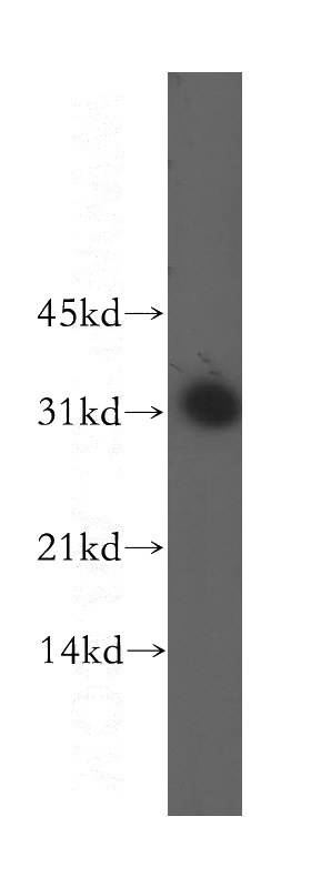 mouse lung tissue were subjected to SDS PAGE followed by western blot with Catalog No:109999(DLX3 antibody) at dilution of 1:1000