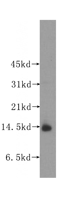 human heart tissue were subjected to SDS PAGE followed by western blot with Catalog No:116634(UQCRB antibody) at dilution of 1:400