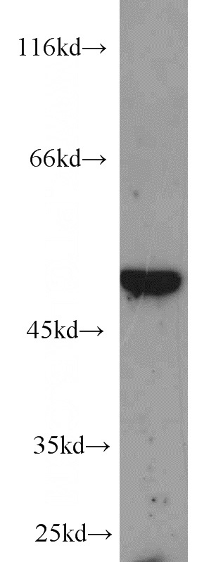 Recombinant protein were subjected to SDS PAGE followed by western blot with Catalog No:117334(MYC-tag antibody) at dilution of 1:4000