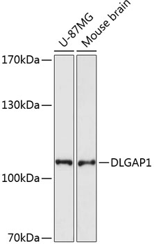 Western blot - DLGAP1 Polyclonal Antibody 