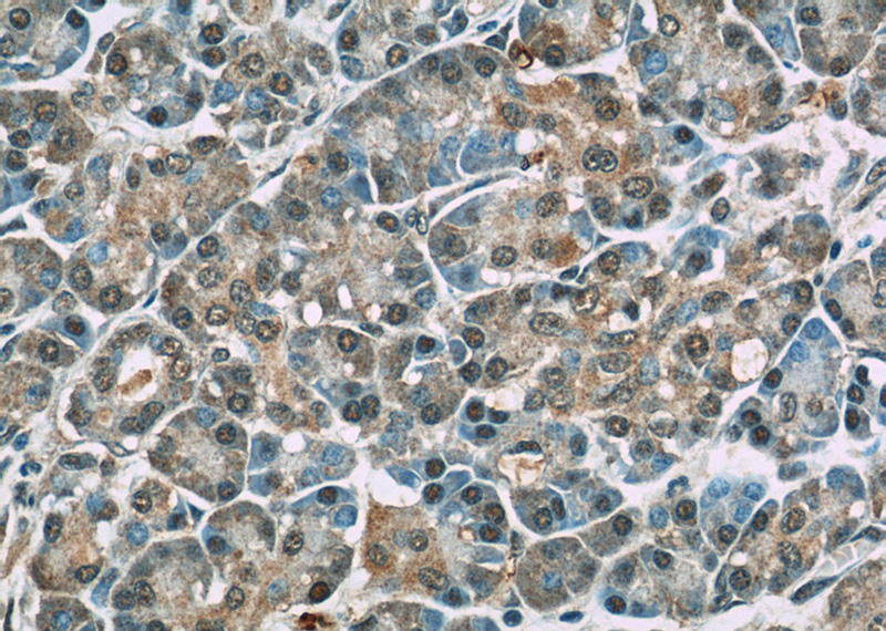 Immunohistochemistry of paraffin-embedded human pancreas slide using Catalog No:115166(SGK1 Antibody) at dilution of 1:50