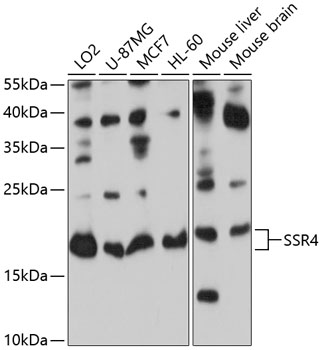 Western blot - SSR4 Polyclonal Antibody 