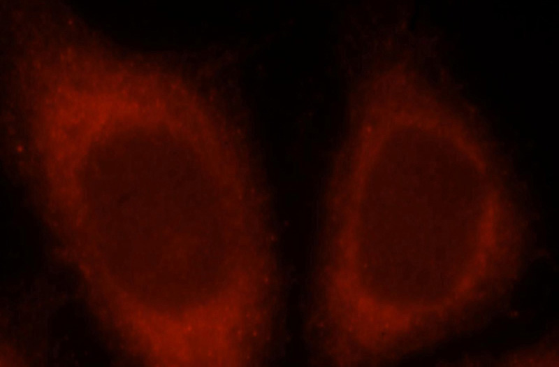 Immunofluorescent analysis of Hela cells, using PIP5K1A antibody Catalog No:113914 at 1:25 dilution and Rhodamine-labeled goat anti-rabbit IgG (red).