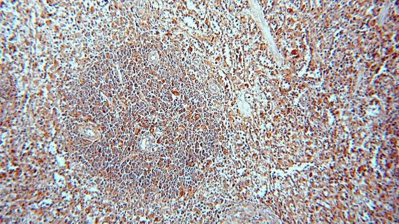 Immunohistochemical of paraffin-embedded human spleen using Catalog No:113487(PAFAH1B3 antibody) at dilution of 1:50 (under 10x lens)
