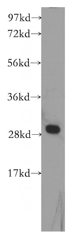 K-562 cells were subjected to SDS PAGE followed by western blot with Catalog No:109989(DLEU1 antibody) at dilution of 1:500