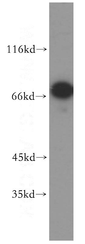 Raji cells were subjected to SDS PAGE followed by western blot with Catalog No:116338(TRAP1 antibody) at dilution of 1:500