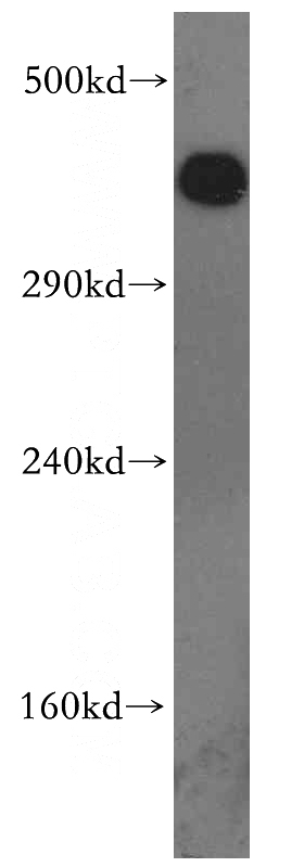 HeLa cells were subjected to SDS PAGE followed by western blot with Catalog No:109957(PRKDC antibody) at dilution of 1:300