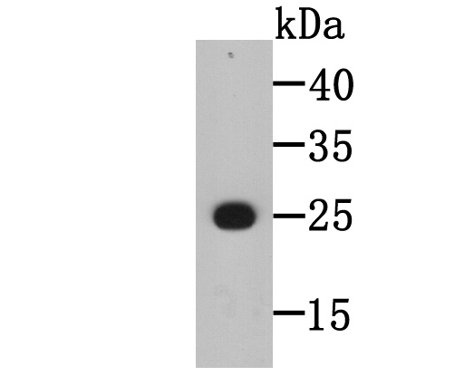 Fig1: Western blot analysis of BLCAP on recombinant protein tissue lysate using anti-BLCAP antibody at 1/5,000 dilution.