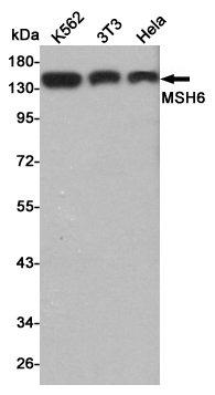 Western blot detection of MSH6 in K562,3T3 and Hela cell lysates using MSH6 mouse mAb (1:500 diluted).Predicted band size:160KDa.Observed band size:160KDa.