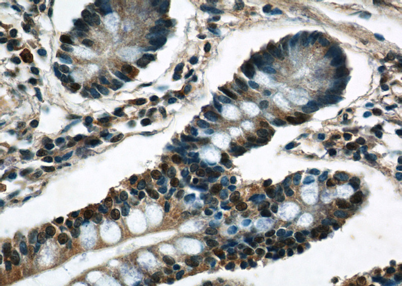 Immunohistochemistry of paraffin-embedded human small intestine tissue slide using Catalog No:108709(C22orf41 Antibody) at dilution of 1:50 (under 40x lens)