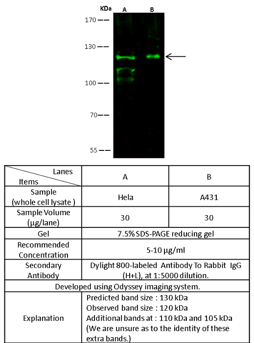 CD103 / Integrin alpha E / ITGAE Antibody, Rabbit PAb, Antigen Affinity Purified, Western blot