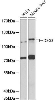 DSG3 Polyclonal Antibody