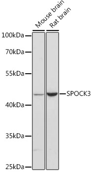 Western blot - SPOCK3 Polyclonal Antibody 