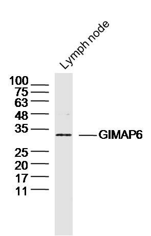 Fig1: Sample: Lymph node (Mouse) Lysate at 40 ug; Primary: Anti-GIMAP6 at 1/300 dilution; Secondary: IRDye800CW Goat Anti-Rabbit IgG at 1/20000 dilution; Predicted band size: 33kD; Observed band size: 33kD