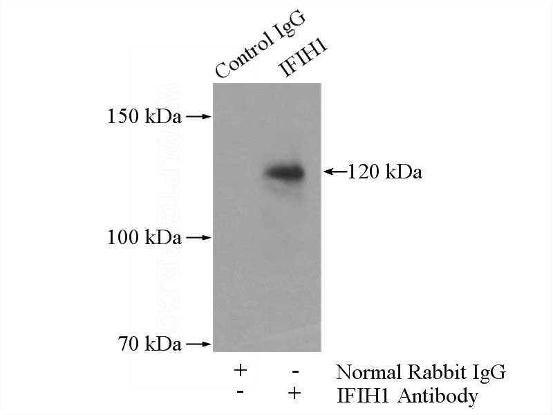 IP Result of anti-IFIH1 (IP:Catalog No:111616, 4ug; Detection:Catalog No:111616 1:800) with Jurkat cells lysate 2400ug.