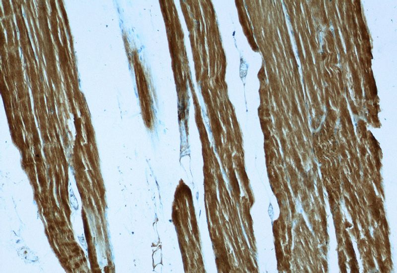 Immunohistochemistry of paraffin-embedded human skeletal muscle slide using Catalog No:107704(ACTA1-Specific Antibody) at dilution of 1:50