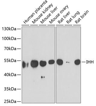 Western blot - IHH Polyclonal Antibody 