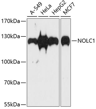 Western blot - NOLC1 Polyclonal Antibody 