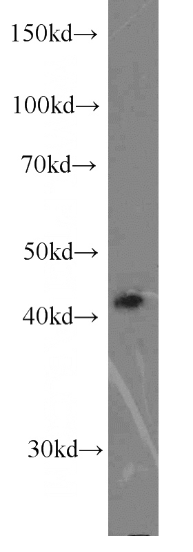 HepG2 cells were subjected to SDS PAGE followed by western blot with Catalog No:111417(HLA-A antibody) at dilution of 1:1000