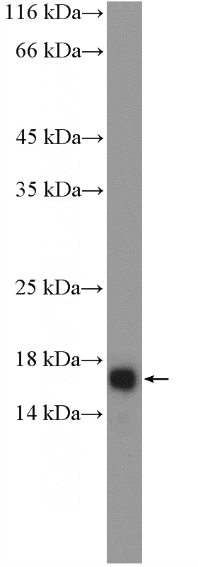 mouse spleen tissue were subjected to SDS PAGE followed by western blot with Catalog No:108927(CAMP Antibody) at dilution of 1:300