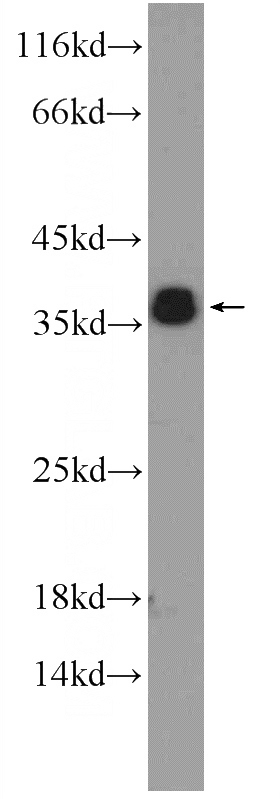 MCF-7 cells were subjected to SDS PAGE followed by western blot with Catalog No:113417(ORAI2 Antibody) at dilution of 1:600