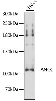 Western blot - ANO2 Polyclonal Antibody 
