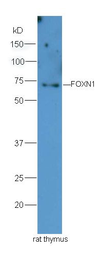Fig2: Sample: Thymus (Rat) Lysate at 40 ug; Primary: Anti-FOXN1 at 1/300 dilution; Secondary: HRP conjugated Goat-Anti-rabbit IgG (bs-0295G-HRP) at 1/5000 dilution; Predicted band size: 69 kD; Observed band size: 69 kD