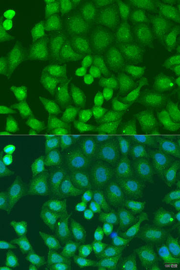 Immunofluorescence - ZFYVE16 Polyclonal Antibody 