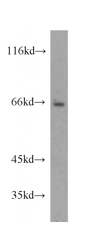 COLO 320 cells were subjected to SDS PAGE followed by western blot with Catalog No:115298(SLC11A2 antibody) at dilution of 1:300
