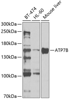 Western blot - ATP7B Polyclonal Antibody 