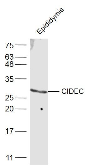 Fig1: Sample:; Epididymis (Mouse) Lysate at 40 ug; Primary: Anti-CIDEC at 1/500 dilution; Secondary: IRDye800CW Goat Anti-Rabbit IgG at 1/20000 dilution; Predicted band size: 27 kD; Observed band size: 27 kD