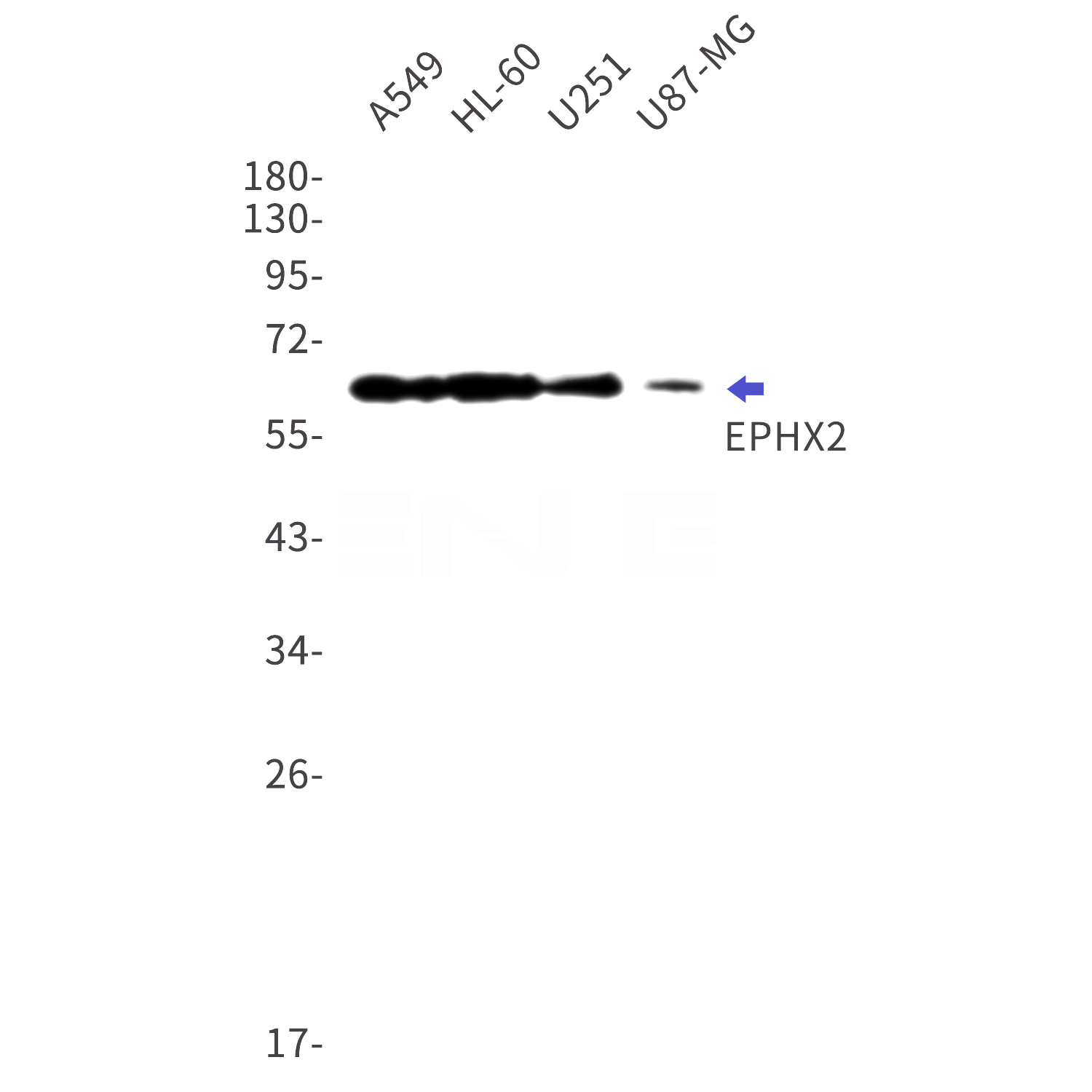 Western blot detection of EPHX2 in A549,HL-60,U251,U87-MG cell lysates using EPHX2 Rabbit mAb(1:1000 diluted).Predicted band size:63kDa.Observed band size:63kDa.