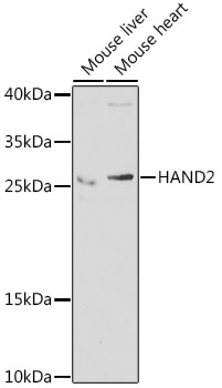 Western blot - HAND2 Polyclonal Antibody 