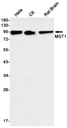 Western blot detection of MST1 in Hela,C6,Rat Brain lysates using MST1 Rabbit mAb(1:1000 diluted).Predicted band size:80kDa.Observed band size:80kDa.