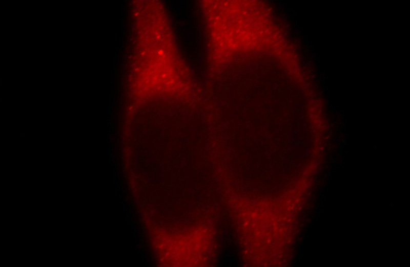 Immunofluorescent analysis of Hela cells, using B4GALT6 antibody Catalog No:108396 at 1:25 dilution and Rhodamine-labeled goat anti-rabbit IgG (red).