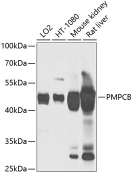Western blot - PMPCB Polyclonal Antibody 