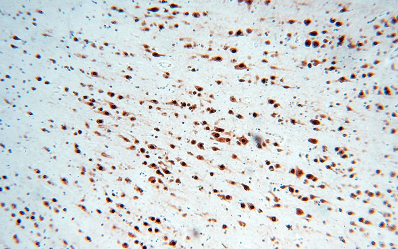 Immunohistochemical of paraffin-embedded human brain using Catalog No:110273(ELAVL2 antibody) at dilution of 1:100 (under 10x lens)