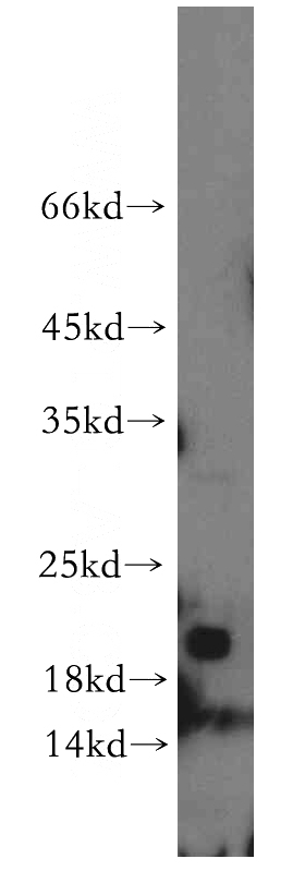 mouse colon tissue were subjected to SDS PAGE followed by western blot with Catalog No:112966(NBL1 antibody) at dilution of 1:100