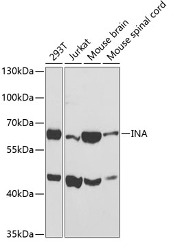Western blot - INA Polyclonal Antibody 