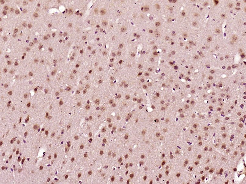 Fig1: Paraformaldehyde-fixed, paraffin embedded (Mouse brain); Antigen retrieval by boiling in sodium citrate buffer (pH6.0) for 15min; Block endogenous peroxidase by 3% hydrogen peroxide for 20 minutes; Blocking buffer (normal goat serum) at 37℃ for 30min; Antibody incubation with (C1orf125) Polyclonal Antibody, Unconjugated at 1:400 overnight at 4℃, followed by operating according to SP Kit(Rabbit) (sp-0023) instructionsand DAB staining.