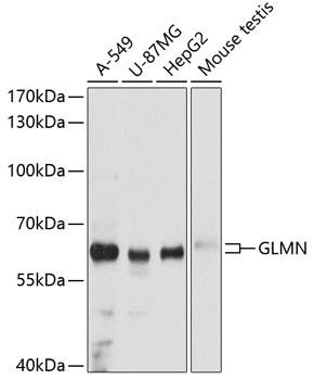 Western blot - GLMN Polyclonal Antibody 