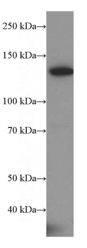 COLO 320 cells were subjected to SDS PAGE followed by western blot with Catalog No:107880(ALPK1 antibody) at dilution of 1:500